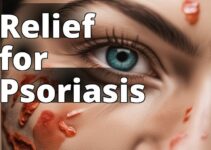 Psoriasis Relief: Unveiling The Benefits Of Cbd Oil